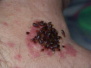 a large group of bed bugs feeding on a human